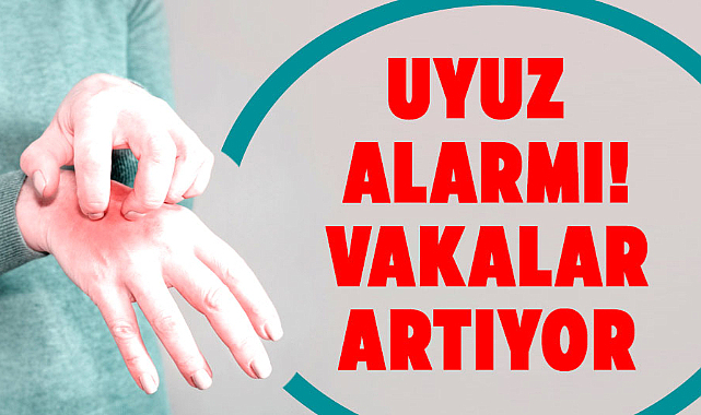 Uyuz alarmı! Vakalar artıyor