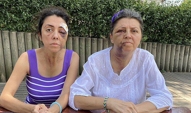 İstanbul Küçükçekmece'de hayvansever iki kız kardeş komşuları tarafından darp edildi