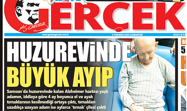 Samsun'da alzheimer hastası huzurevinde aylarca tırnak çilesi çekti