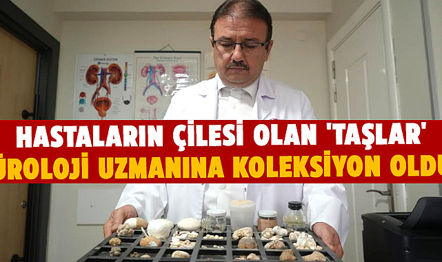 Samsun'da hastaların taşları doktorun koleksiyonu oldu