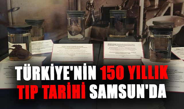 Türkiye'nin 150 yıllık tıp tarihi Samsun'da