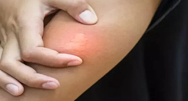 Batı Nil virüsü yeniden kendini gösteriyor! Vakalar görülmeye başlandı 