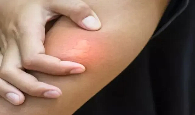 Batı Nil virüsü yeniden kendini gösteriyor! Vakalar görülmeye başlandı 