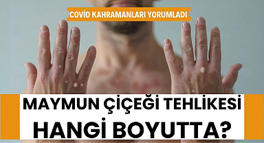 Covid salgını kahramanları maymun çiçeği hakkında açıklama yaptı