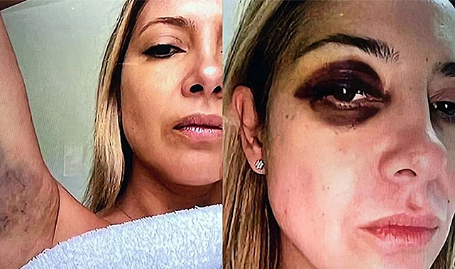 Cumhurbaşkanı karısını darp etti