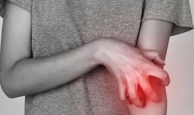 Mağazalarda ‘uyuz’ riski, yeni alınan kıyafetlere dikkat!