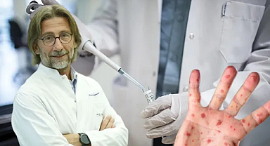 Samsunlu Ercüment Ovalı’dan Maymun Çiçeği aşısını buldu iddiası 