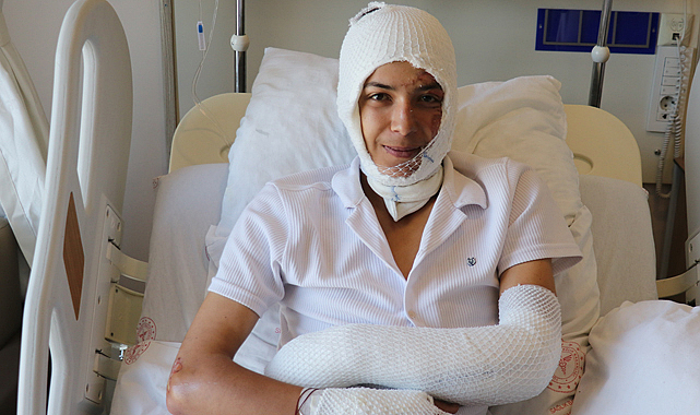 Sivas'ta,  17 yaşındaki Buğra Türkseven'in elektronik sigarası elinde patladı