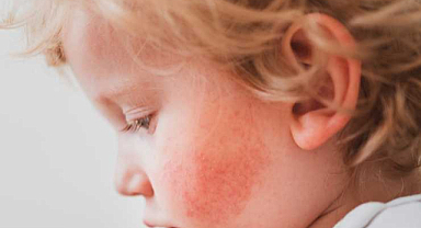 Virüs'te vakalar yüzde 40 patladı!