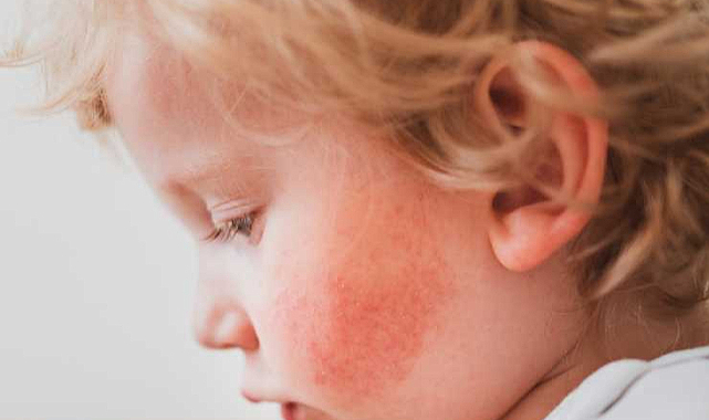 Virüs'te vakalar yüzde 40 patladı!