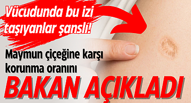 Vücudunda bu izi taşıyanlar şanslı! Maymun çiçeğine karşı korunma oranını Bakan açıkladı