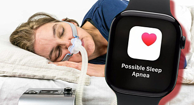 Apple Watch FDA onayı aldı! Uyku apnesi yapılacak