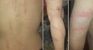 Gazi üniversitesinde işkence! Ülkü ocakları mensuplarına suç duyurusu