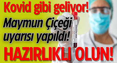 Kovid gibi geliyor! Maymun Çiçeği uyarısı yapıldı! Hazırlıklı olun!