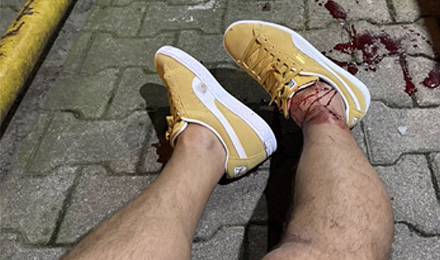 Serhat Akın vuruldu