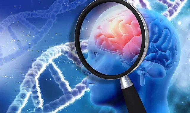 Beynini seven bunlardan kaçınsın! Beyin sağlığı için bu gıdalardan uzak durun