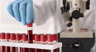 En uzun ömürlü kan grubu açıklandı