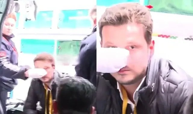 Galatasaray-Beşiktaş maçı sonrası muhabire yumruklu saldırı!