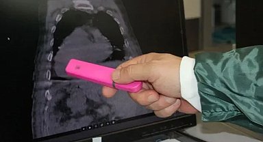 Giresun Sendromu: Tıp literatüründe yeni çığır, Türkiye ve dünyada ilk