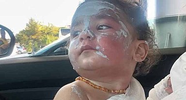 Kreşte 1.5 yaşındaki çocuğun üstüne kahve döküp yaktılar