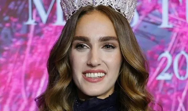Miss Turkey birincisi İdil Bilgen’in şaşırtan yeni hali! Estetik mi yaptırdı?
