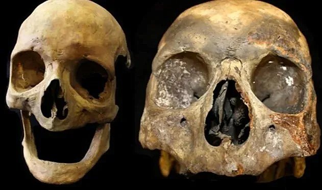 Sigaranın büyük yan etkisi ortaya çıktı: Öldükten sonra bile devam 