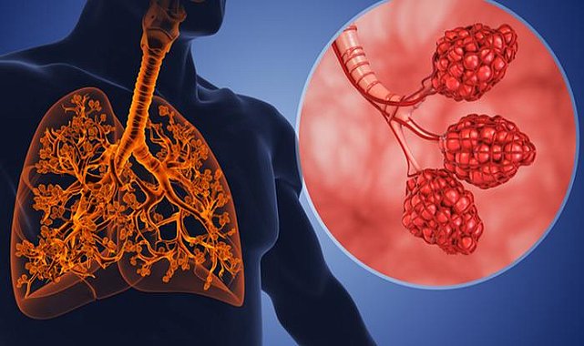 50 yıl sonra gelen devrim! Astım ve KOAH için çığır açan tedavi yöntemi keşfedildi...