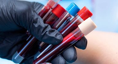 Bu kan grubuna sahip kişilerin felç riski yüksek