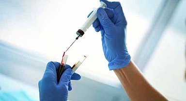 Bu kan grubuna sahip olanlar dikkat! Bunama riski yüzde 82 daha fazla