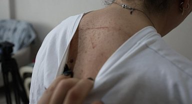 Ev sahibi kiracı tartışmasında çivili sopalar konuştu