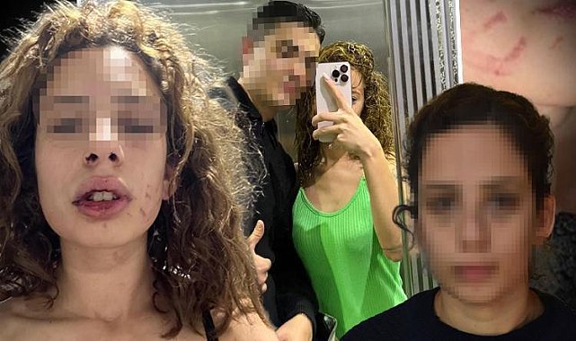 Konya'da kız arkadaşına dehşeti yaşatmıştı! Sevgiliden yüzsüz savunma