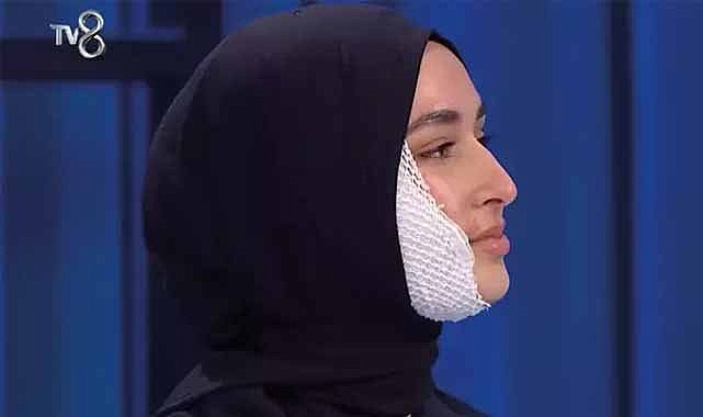 MasterChef'te yüzü yanmıştı! Beyza Huri Aydın yarışmaya devam edecek mi?