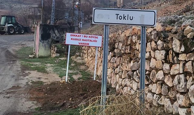 7 yaşındaki çocuğa saldıran köpek kuduz çıktı! Bir köy 6 ay karantinaya alındı