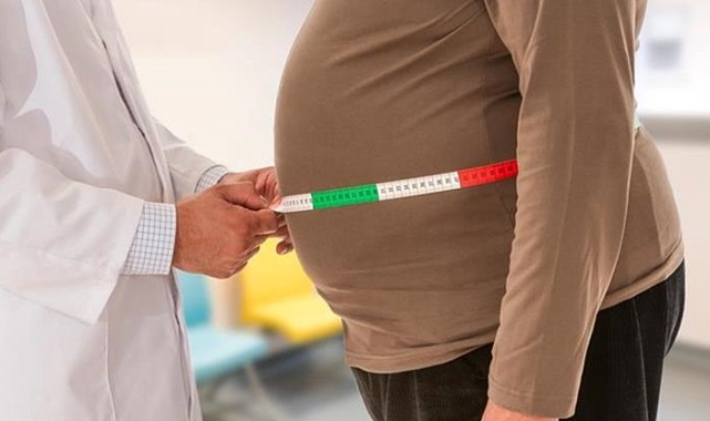 'Bu kilo sorunu değil bir hastalık' Uzman isimden obezite hakkında çarpıcı uyarılar!