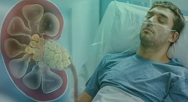 Erkeklerde daha fazla görülüyor: İdrarda kanama ve ağrıya dikkat!