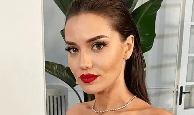 Fahriye Evcen kazada yaralandı