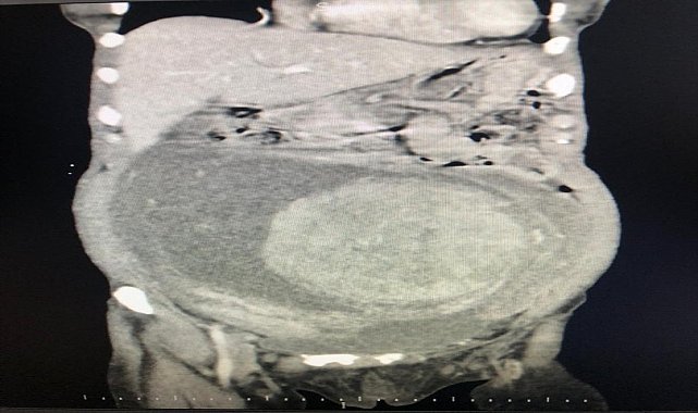 Karın ağrısıyla gittiği hastanede hayatının şokunu yaşadı