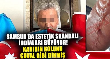 Samsun'da estetik skandalı iddiaları büyüyor! Kadının kolunu çuval gibi dikmiş