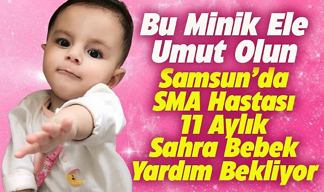Samsun'da SMA hastası 11 aylık Sahra umut arıyor