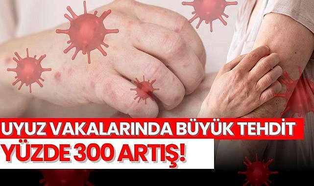 Uyuz vakasında büyük tehdit: Yüzde 300 artış!