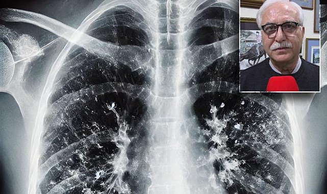 4 saat içinde tedaviye başlanmazsa ölümle sonuçlanabiliyor! Griple karıştırmayın