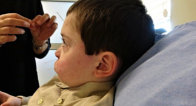 Akupunktur minik Burak'a umut oldu