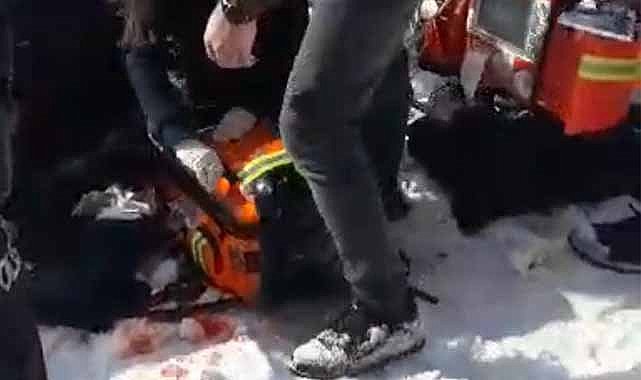 Başıboş köpekler 12 yaşındaki kız çocuğuna saldırdı! Ağır yaralandı