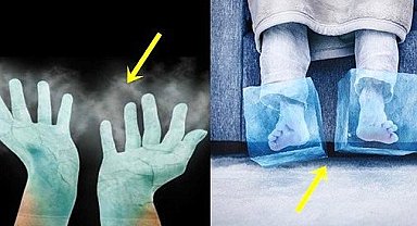 El ve ayak üşümesi olanlar dikkat: Bu hastalık olabilir! Uzman isim açıkladı