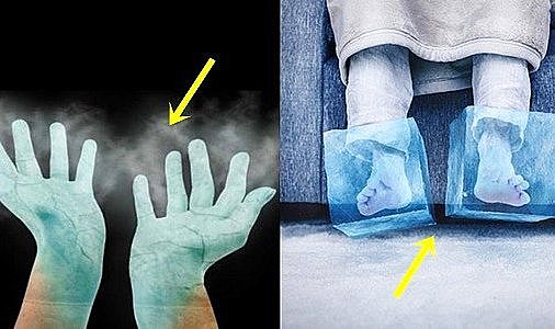 El ve ayak üşümesi olanlar dikkat: Bu hastalık olabilir! Uzman isim açıkladı