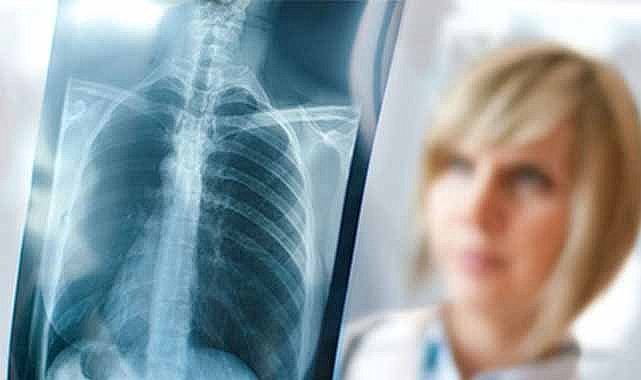 Hastanelerde zatürre alarmı!