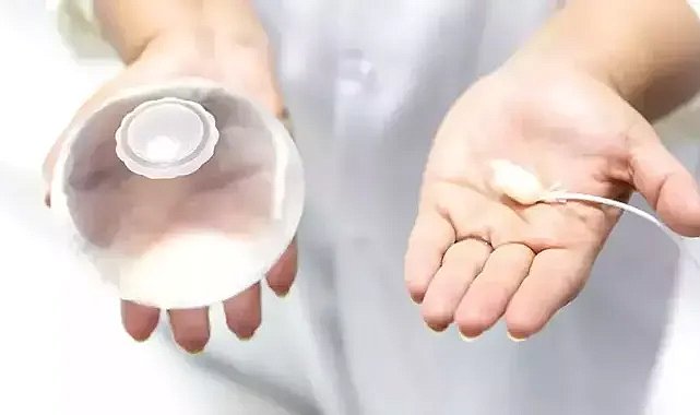 Mide balonu Türkiye'de durduruldu: TICK'dan açıklama