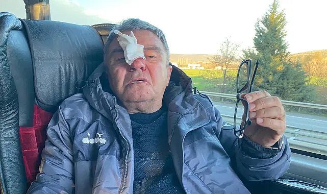 Sportif direktöre şok saldırı: Deplasman dönüşü burnu kırıldı!