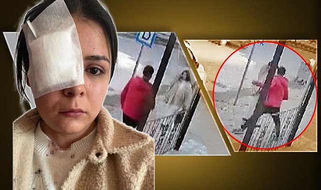 Yolda yürüyen genç kıza yumruk atmıştı! Savunması pes dedirtti