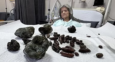 92 yaşındaki kadının midesinden çıkanlar şok etti! Zeytin ve hurmayı çekirdeğiyle tüketmeyin